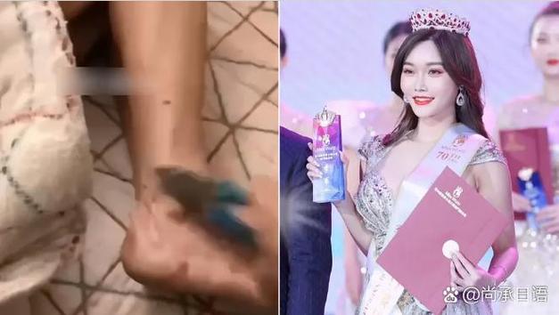 CJ雅典娜事件始末：性感Showgirl的命运