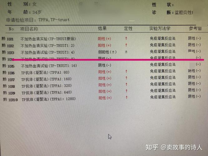 想知道 tpp fpp 的区别吗？这篇文章给你讲透了！